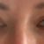 Spadnute horne viecka (hooded eyes, u mna dane geneticky)